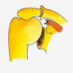 Cuff arthropathy