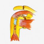 Biceps - tendonitis