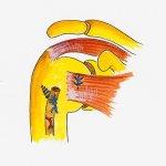 tenodesis