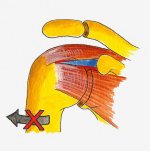 Frozen shoulder