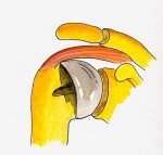 Treatment options with intact cuff
