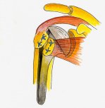 Replacement Hemi-arthroplasty